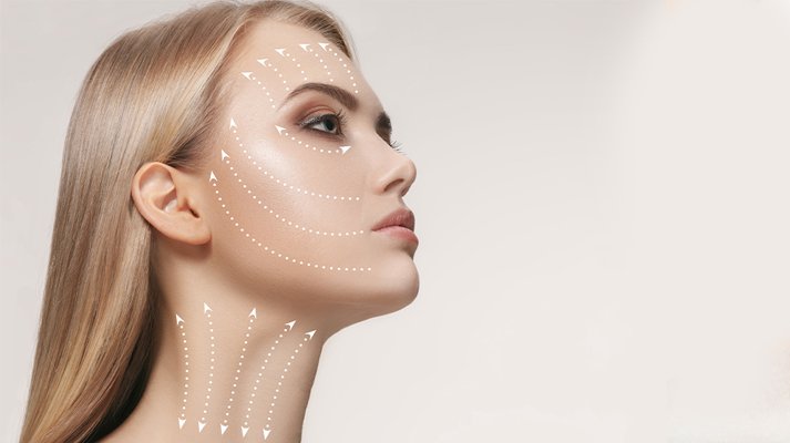 Face Lifting